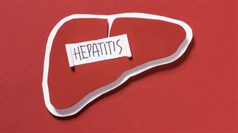 ilustrasi hepatitis akut